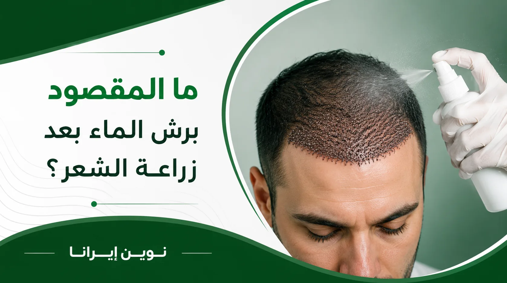ما المقصود برش الماء بعد زراعة الشعر؟